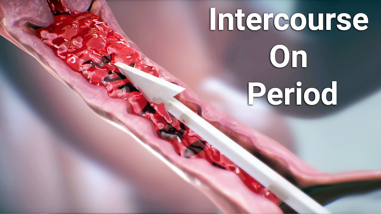 Intercourse on period-woman can get pregnant during her period