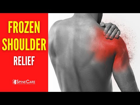 How to Fix a Frozen Shoulder at Home