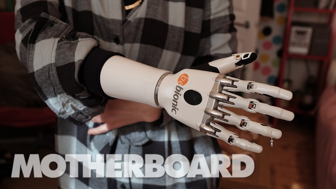 Living With Future Prosthetics