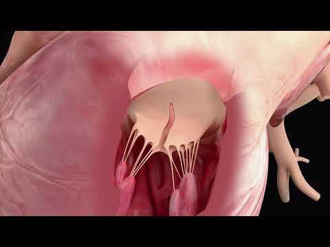 Demonstration of the LAMPOON procedure