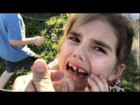 FAIL! Kids Pull Loose Tooth With Rocket!