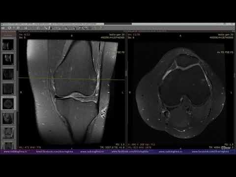 Lecția de genunchi 20