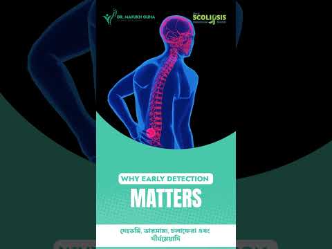 SPOT THE SIGN, SAVE A SPINE 💚| Dr Mayukh Guha
