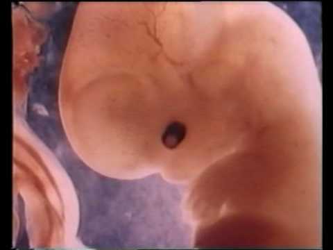 Scricchiolio delle articolazioni del ginocchio che curare Dolore sulla tavoletta sinistra