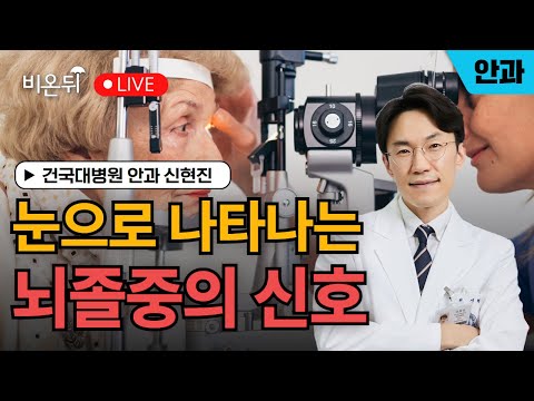 비온뒤 - 눈으로 나타나는 뇌졸중의 신호 - 부제: 뇌졸중, 눈 증상 총정리
