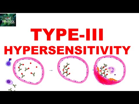 Type III Hypersensitivity | Immune complex mediated Hypersensitivity | Mechanism | Examples