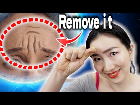 "I Canceled Botox After Doing this for 2 weeks!" Remove 11 Lines and Frown Wrinkles on Forehead