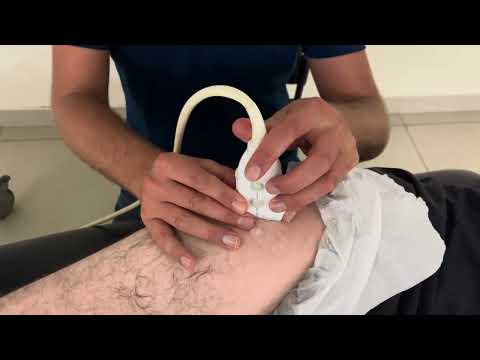 MSK Ultrasound - Hip - Gluteus medius anterior tendon