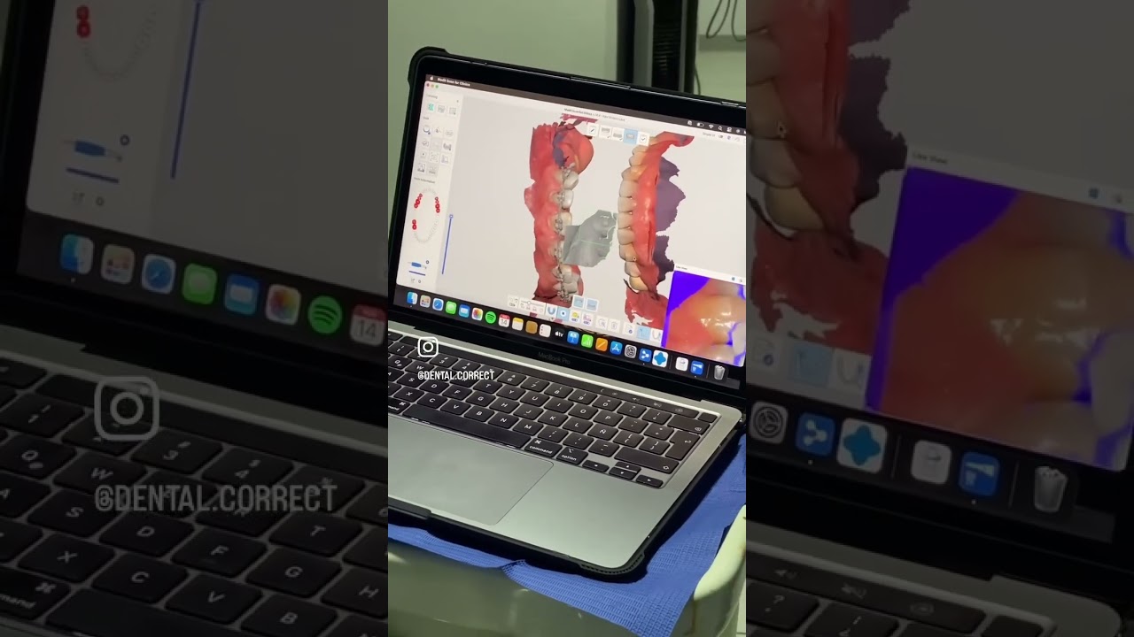 Aide Montserrat Orozco Gutierrez-56