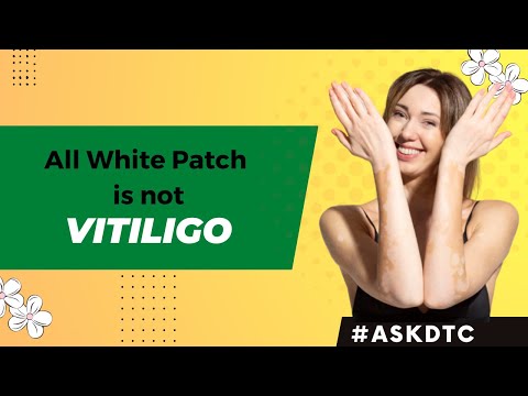 How to identify Vitiligo or white spots on the skin | Dr. Rohit Goel