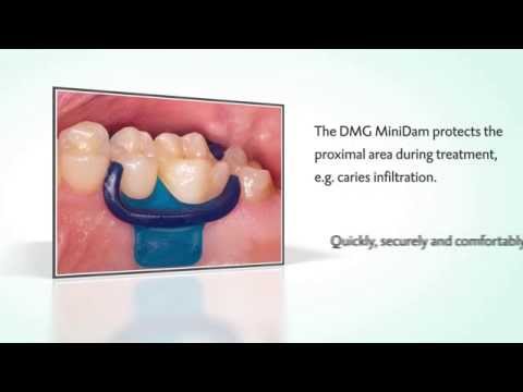 DMG MiniDam: Quick Protection - where it's needed