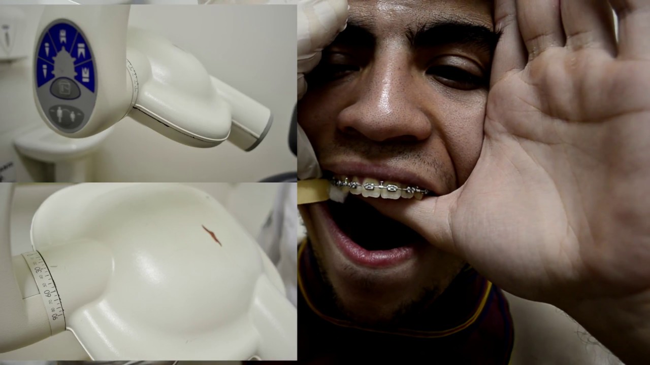 Métodos Radiográficos de Localização em Odontologia