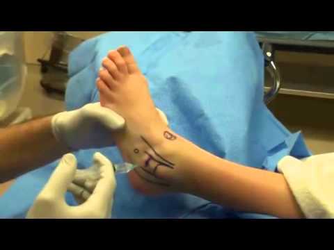 Clinica de tratament a articulațiilor genunchiului