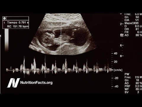 Childhood Constipation and Cow s Milk