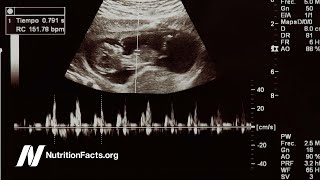 Preventing Heart Disease In the Womb