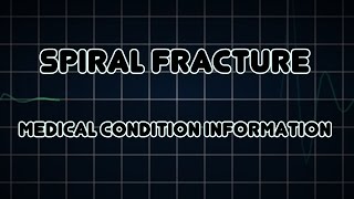 Spiral fracture (Medical Condition)