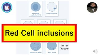 Download Lagu RBCs inclusion bodies: indicators of anemia and lead poisoning | Hematology | by Imran Yaseen Thumbnail