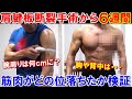 手術後6週間の筋肉の左右差を腕周りと胸や背中を比較して検証!筋トレを休んだ時の筋肉の落ち方【腱板断裂】