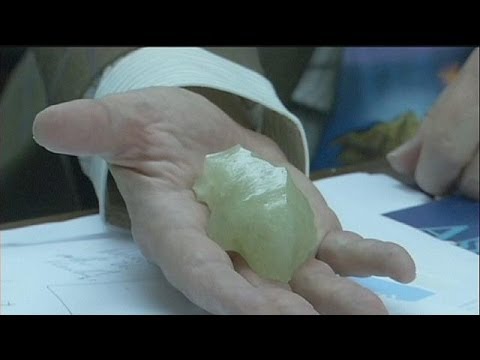 Hip osteocondrosi congiunta Dolore nel dolore alladdome e alla schiena inferiore