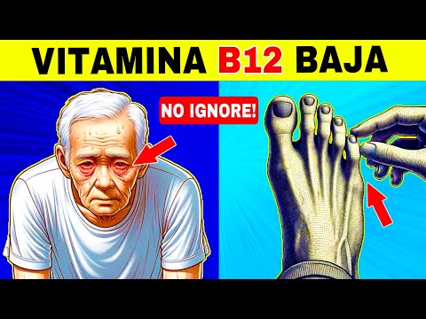 7 SIGNOS EXTRAÑOS de BAJA VITAMINA B12 (Síntomas de deficiencia de vitamina B12)