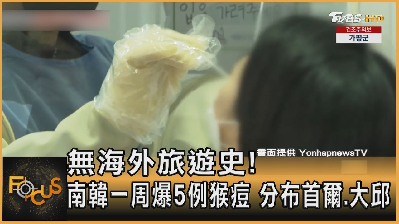 無海外旅遊史！南韓一周爆5例猴痘　分布首爾.大邱