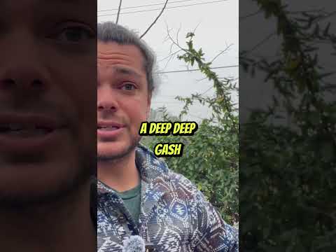 Comfrey's Healing Power: Natural Remedies Explored