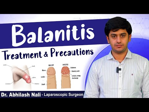 Best Balanitis Treatment || Best Treatment for Balanoposthitis || Circumcision || Dr Abhilash Nali