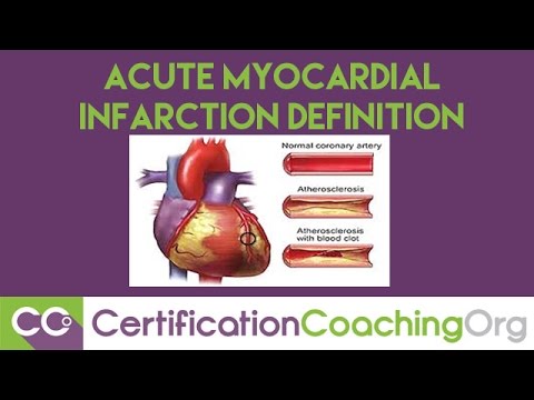 ICD-10 Subsequent Acute Myocardial Infarction Definition Video