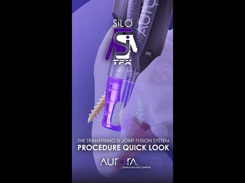 SiLO TFX™ Procedure - Quick look Animation
