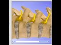 3D Adjustment of Thoracic