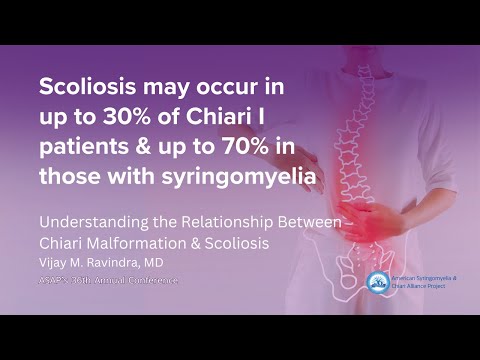 Understanding the Relationship between Chiari Malformation and Scoliosis - Vijay Ravindra, MD
