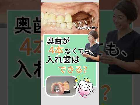 奥歯が4本なくても入れ歯はできる？