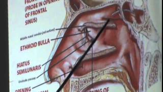 30) Dr. Manal 1- 12- 2014 [Nasal cavity-  Paranasal sinuses-  Maxillary sinuses]