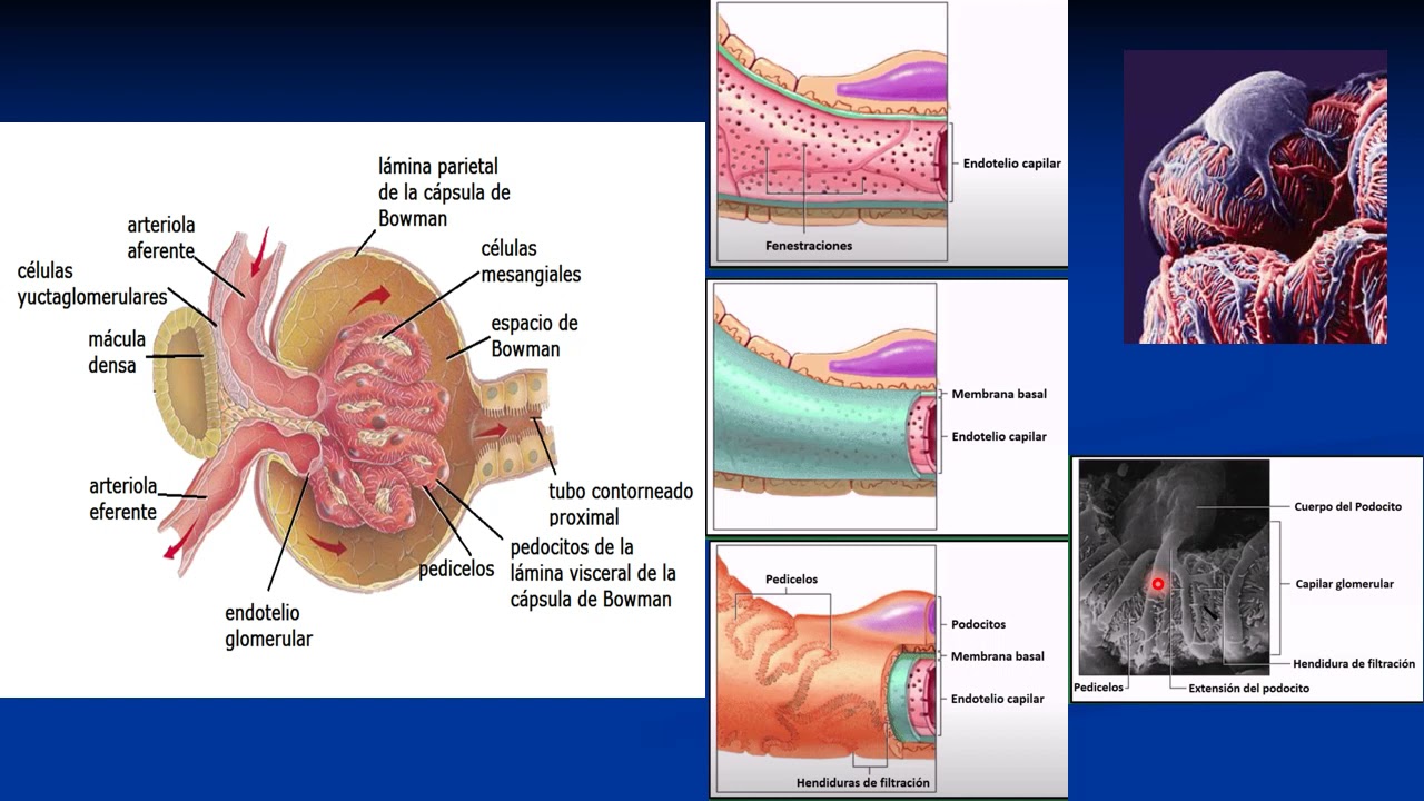 La Nefrona: Formación de la orina