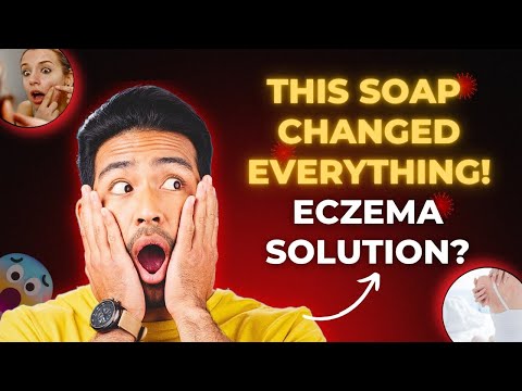 Rudramani ayurvedic  anti fungal malam  & fungal infection s...