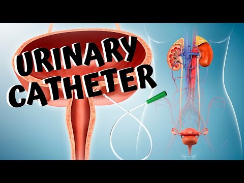 How to Perform Self Catheterization for Urinary Retention at Home