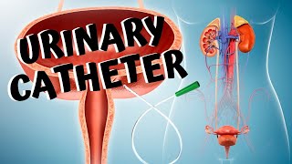 How to Perform Self Catheterization for Urinary Retention at Home