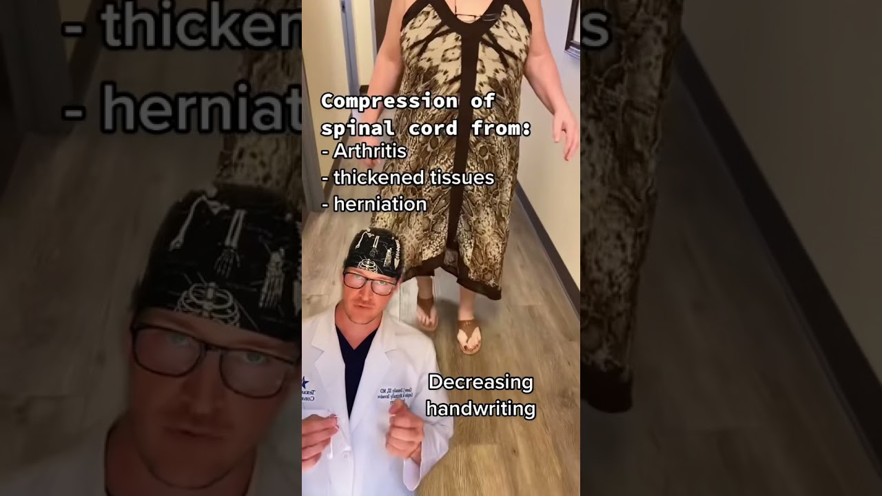 Cervical Myelopathy Facts