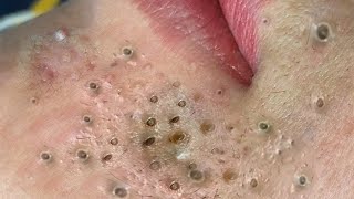 𝘚ℎ𝘢𝑟𝘦 𝘵𝑖𝘱𝑠 𝑓𝘰𝑟 𝑐𝘭𝑒𝘢𝑛𝘪𝑛𝘨 𝘢𝑛𝘥 𝘵𝑎𝘬𝑖𝘯𝑔 𝑐𝘢𝑟𝘦 𝘰𝑓 𝑦𝘰𝑢𝘳 𝘧𝑎𝘤𝑒 #35