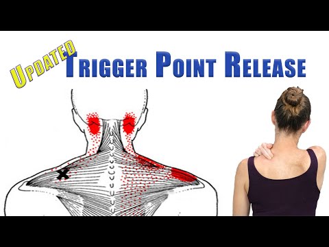 TRIGGER POINT RELEASE Upper Trapezius, Levator Scapulae, and Suboccipitals | UPDATED with back view
