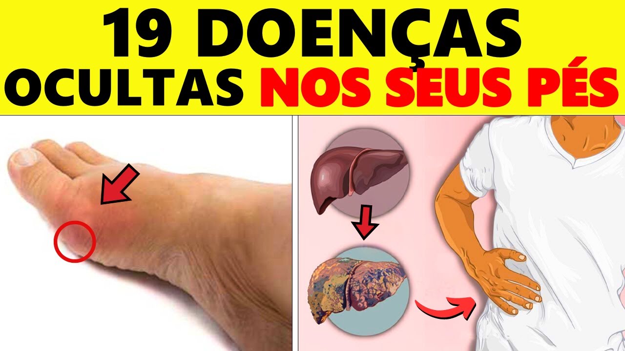 ALERTA! Descubra os 19 SINAIS de DOENÇA nos SEUS PÉS, que NINGUÉM TE CONTA