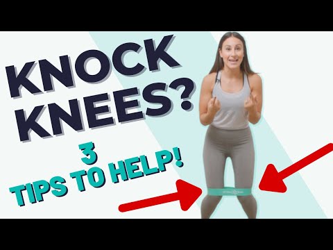 Knock Knees?! 3 Strategies to help