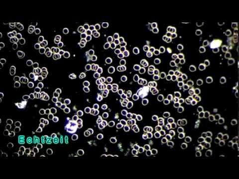 Krasnodar Prostata Ultraschall Prostata-MRT in Nischni Nowgorod