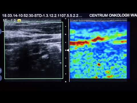 Medycyna po prostu - Odcinek 10 - USG szyi