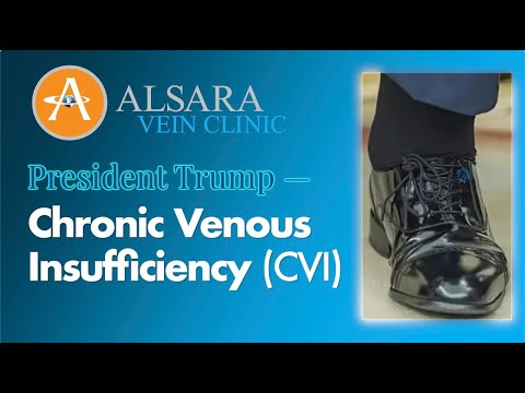 President Trump: Chronic Venous Insufficiency (CVI) - Alsara Vein Clinic