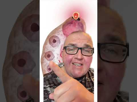 What does ovulation look like?