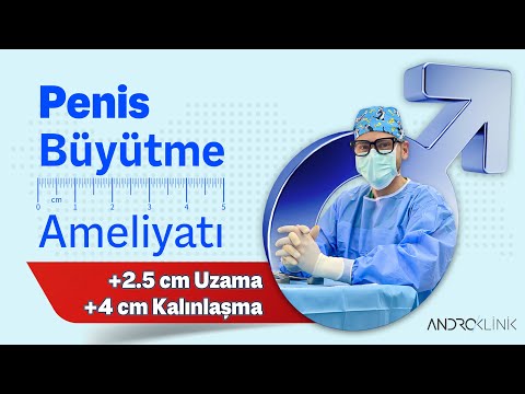 Penis Büyütme Ameliyatı (+2.5 cm uzama, +4 cm kalınlaşma)