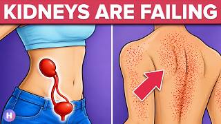 15 Signs Your Kidneys Are Crying For Help