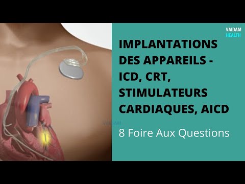 IMPLANTATIONS DES APPAREILS - ICD, CRT, stimulateurs cardiaques, AICD