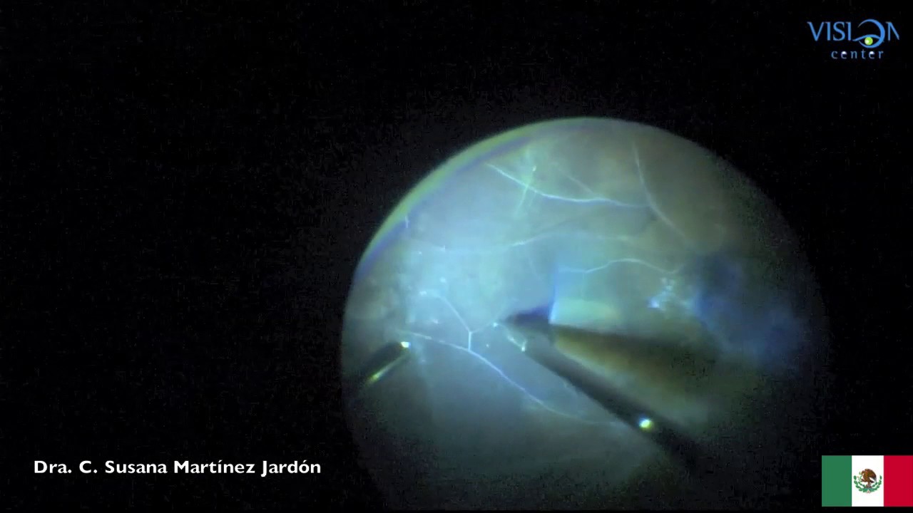 C. Susana Martinez Jardon-24